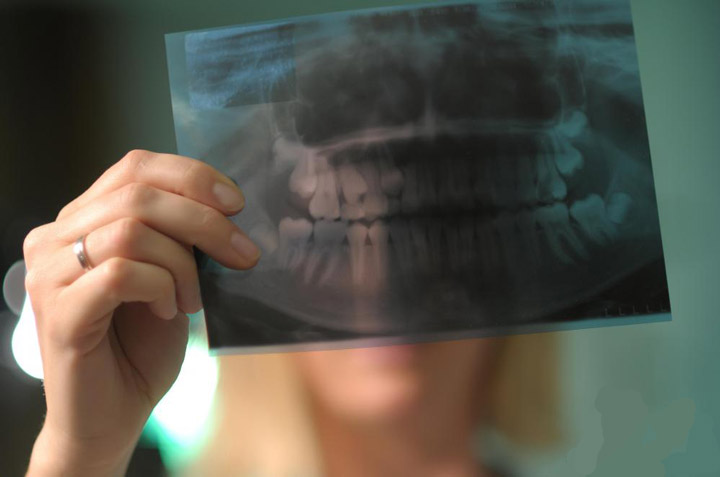 Imagerie digitale dentaire : qu’est-ce que c’est, et en quoi cela aide-t-il à soigner vos dents ?