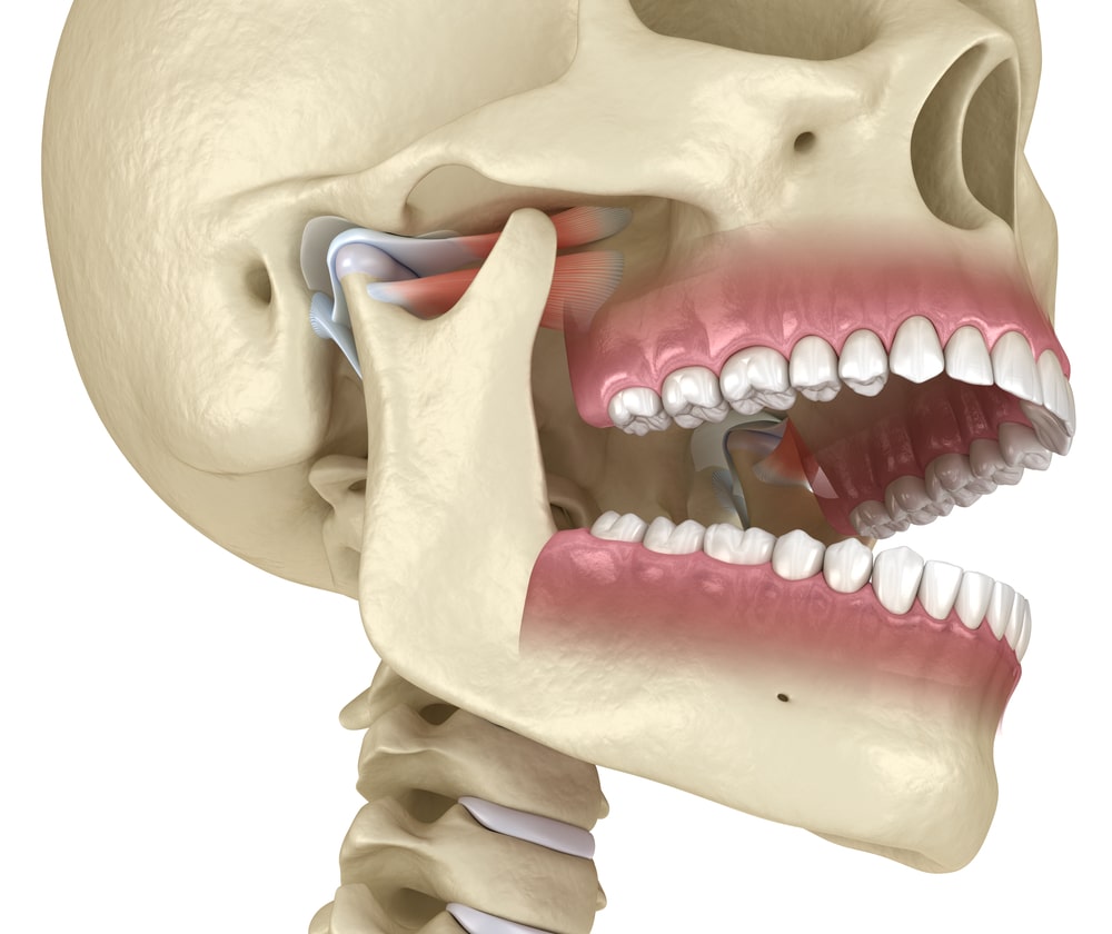 Les troubles aux articulations temporo-mandibulaires