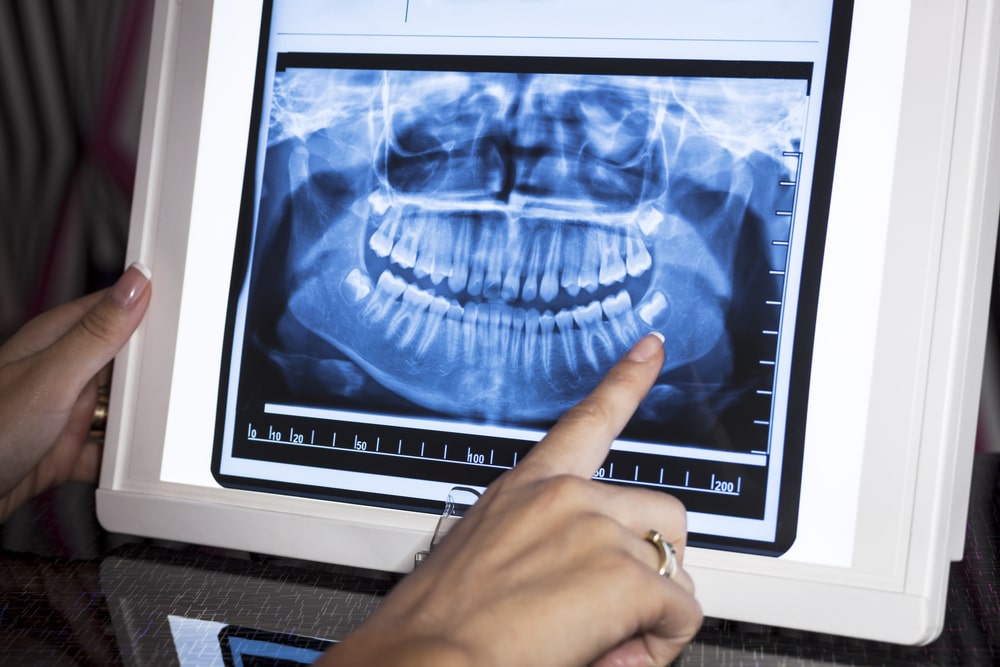 Des radiographies dentaires numériques