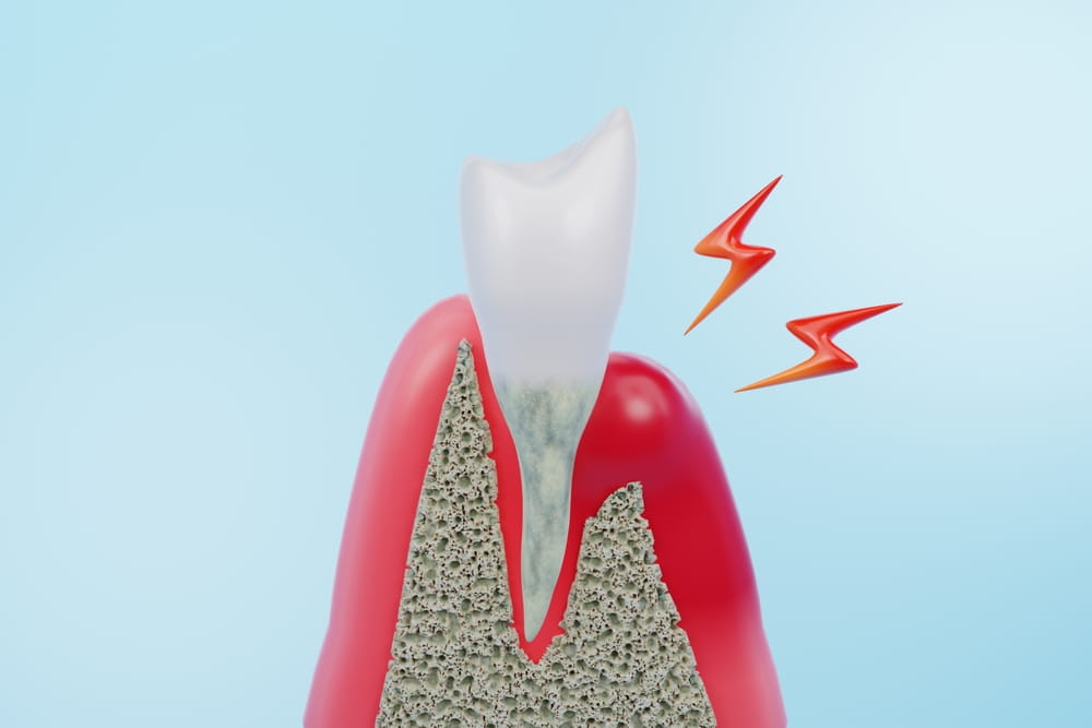 Récession gingivale : les signes à ne pas ignorer et les habitudes à corriger